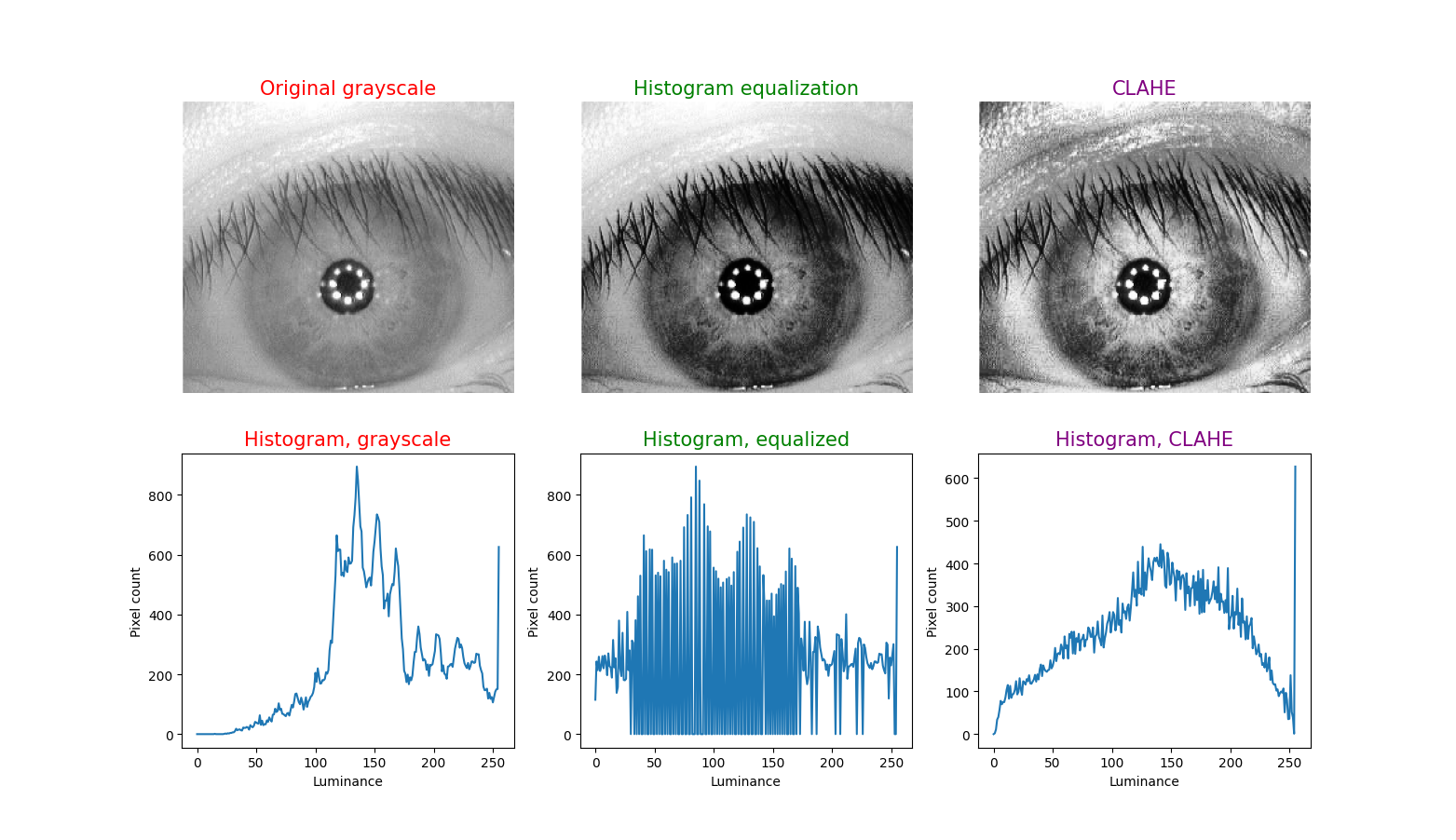 Figure 5: Upper left image is from: https://www.researchgate.net/publication/248390988_An_Investigation_of_Quality_Aspects_of_Noisy_Colour_Images_for_Iris_Recognition. This has been converted by histogram equalization in the upper middle image, and by CLAHE in the upper right image. Below each iris image is the corresponding histogram.