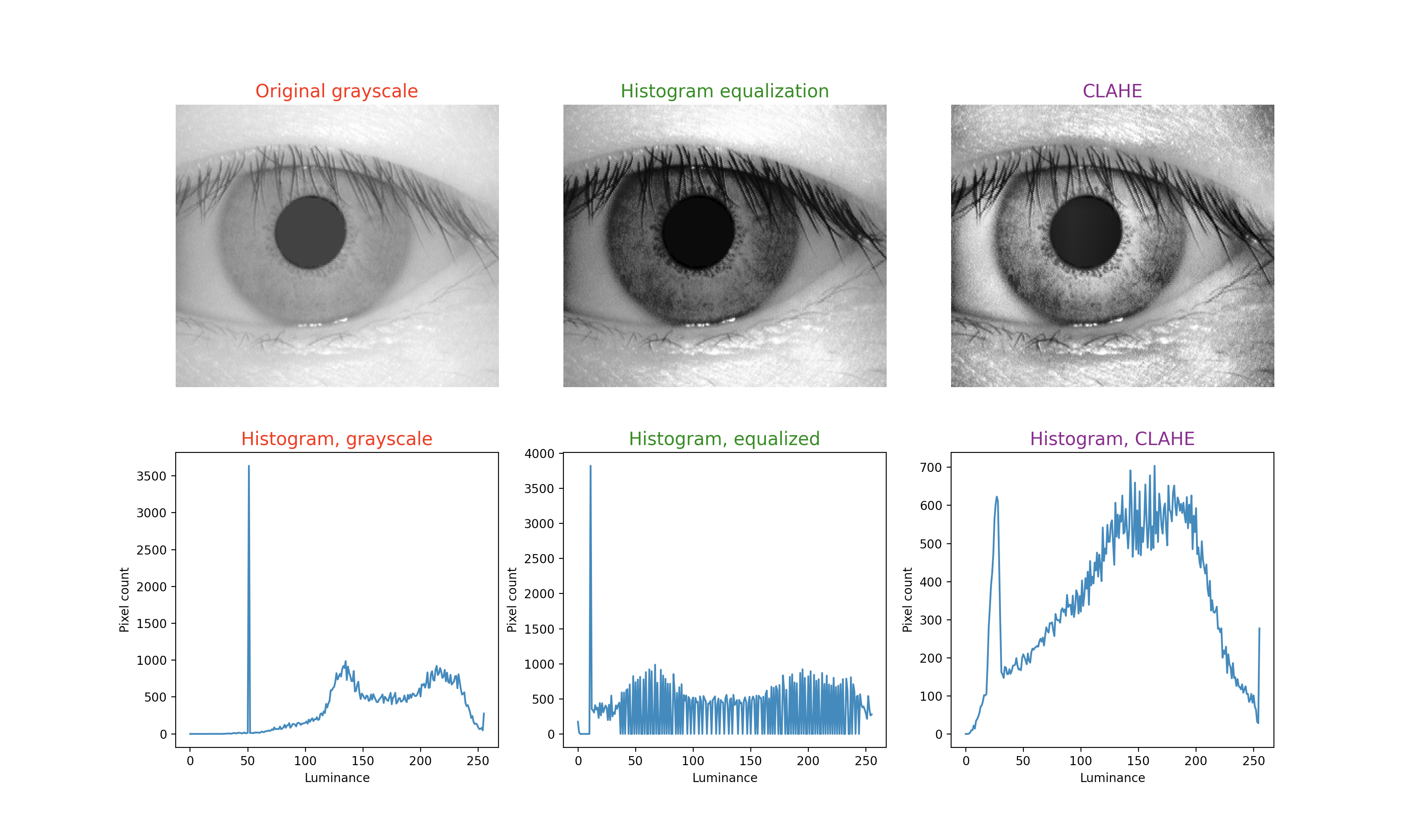 Figure 1: Upper left image is the unprocessed sample 005-01-01 from the CASIA database. This has been converted by histogram equalization in the upper middle image, and by CLAHE in the upper right image. Below each iris image is the corresponding histogram.