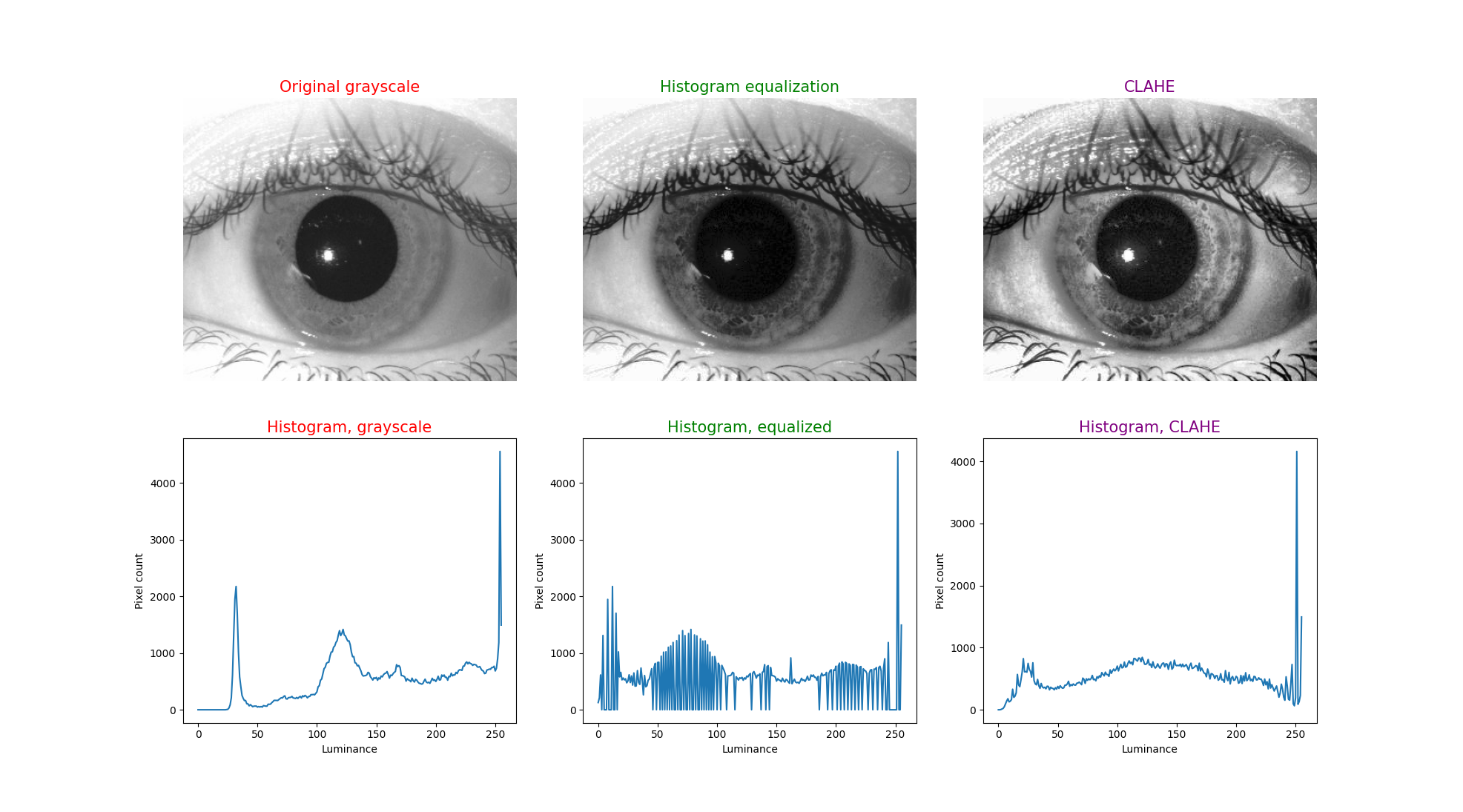 Figure 6: Upper left image is from: https://ieeexplore.ieee.org/document/8572723. This has been converted by histogram equalization in the upper middle image, and by CLAHE in the upper right image. Below each iris image is the corresponding histogram.