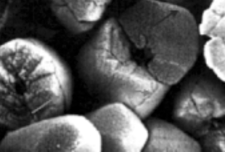 Figure: Electron micrograph of otoconia in an older individual (Walther and Westhofen 2007).
