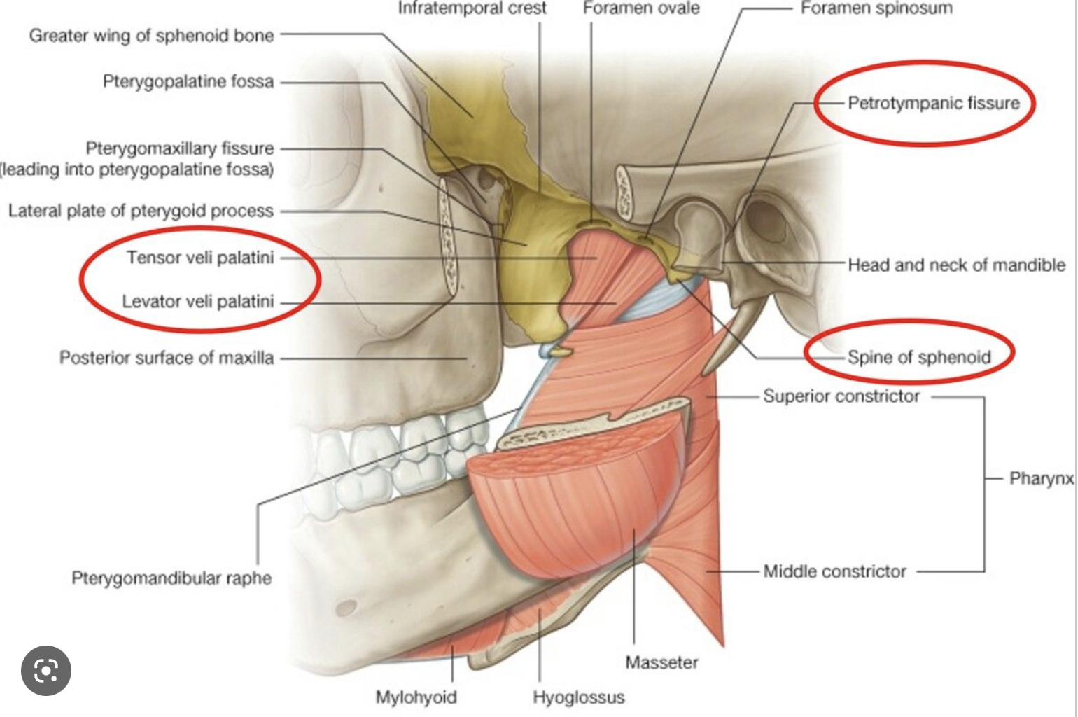 Figure: Different components of the temporomandibular joint, including the petrotympanic fissure.  From https://www.pinterest.com/pin/295126581824055955/ (accessed 1/31/23).