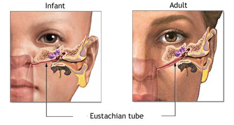 Figure: Different orientations of the Eustachian tube in a healthy infant versus a healthy adult.  From https://ent-surgery.com.au/the-eustachian-tube/ (accessed 2/14/23).