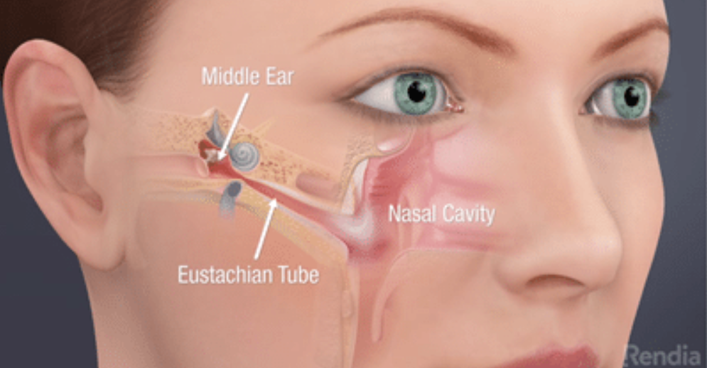 Figure: Location and orientation of the right Eustachian tube in a healthy adult.  From https://coastalearnoseandthroat.com/blog/do-you-have-etd/ (accessed 2/14/23).
