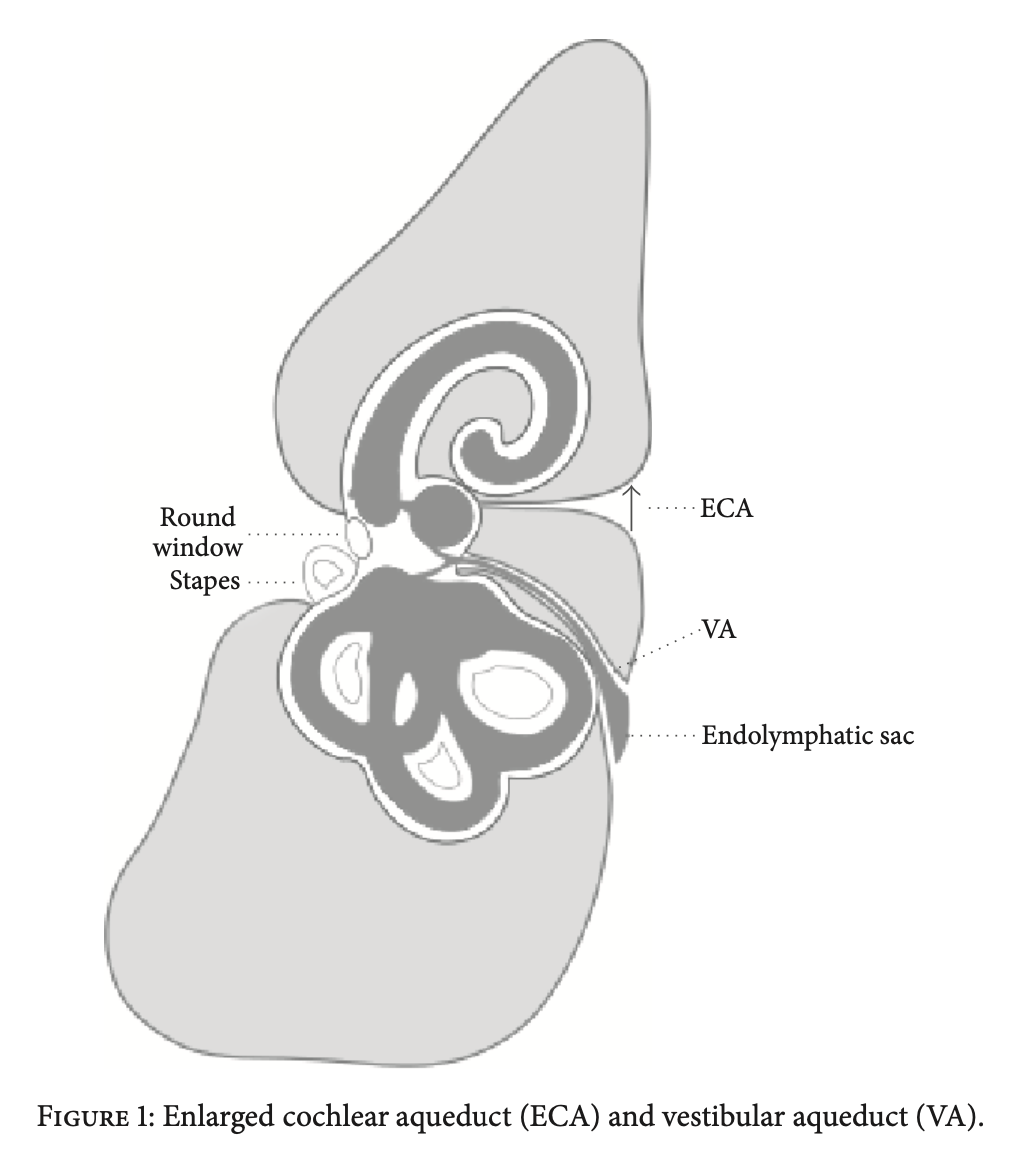 Figure: Schematic depiction of the relative disposition of the cochlear aqueduct and nearby structures.  From Bianchin et al. (2016).
