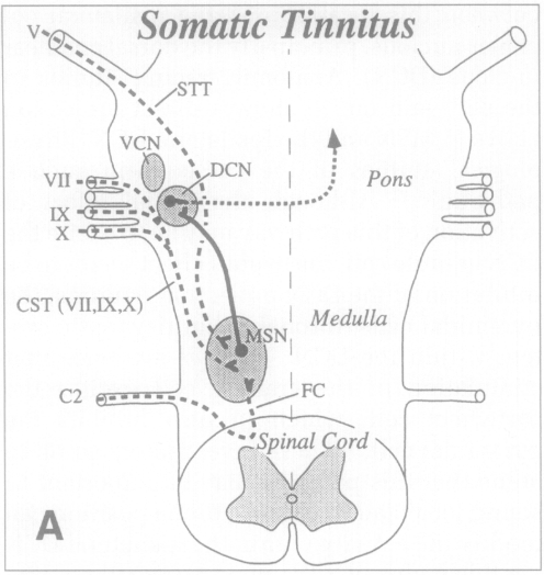 Figure: Schematic diagram of brainstem and upper cervical spinal cord, depicting the anatomic basis for the dorsal cochlear nucleus hypothesis, from Levine (1999).