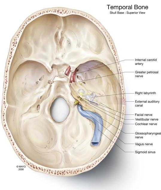 Figure: Superior aspect of the skull base with annotated features of the temporal bone.  From Gladwell and Viozzi (2008).