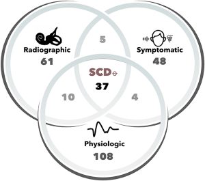 Figure: Venn diagram depicting that the greatest confidence of semicircular canal dehiscence can be achieved when the clinical history, audiologists and otovestibular testing, and imaging are all compatible with the diagnosis.  From Tran et al. (2020).