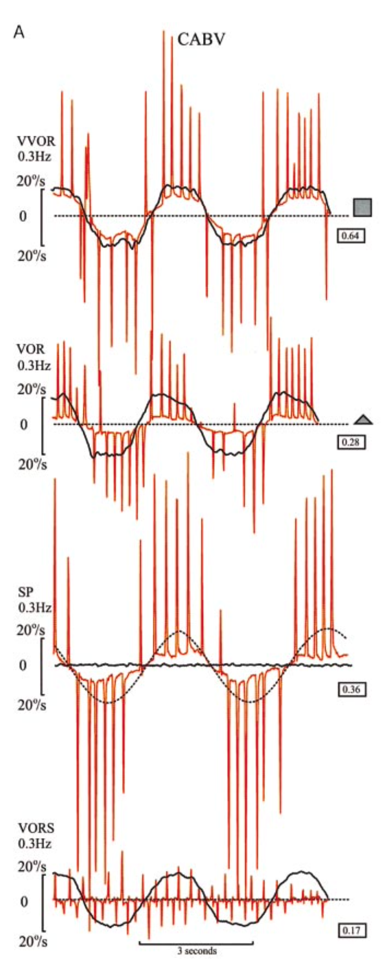 Figure: CANVAS patients, testing of VVOR (visual vestibulo-ocular reflex), VOR (vestibulo-ocular reflex), SP (smooth pursuit) and VORS (vestibulo-ocular reflex visual suppression).  From Migliaccio et al. (2004).