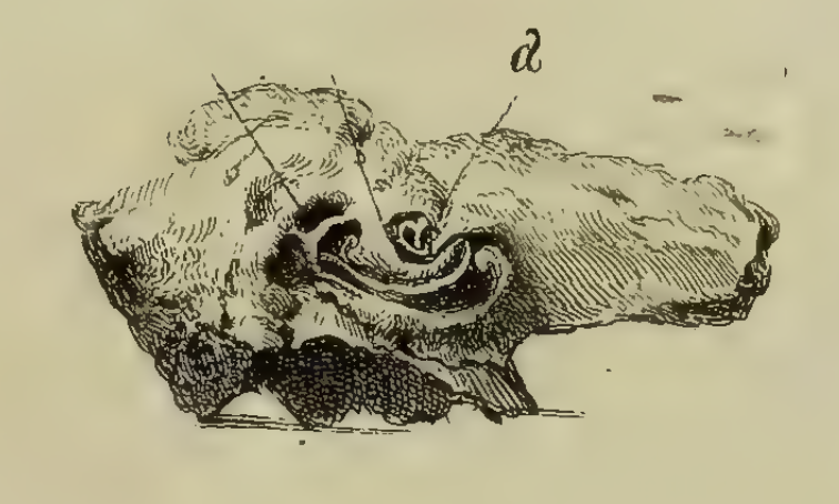 Figure: Illustration of the gross anatomy of a temporal bone in which the cochlea has only 1.5 turns.  From Mondini (1791).