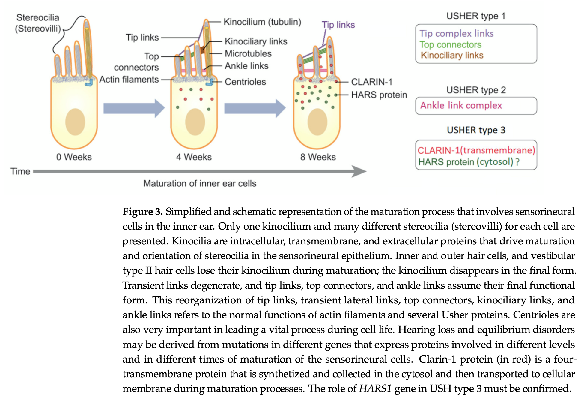 Usher syndrome