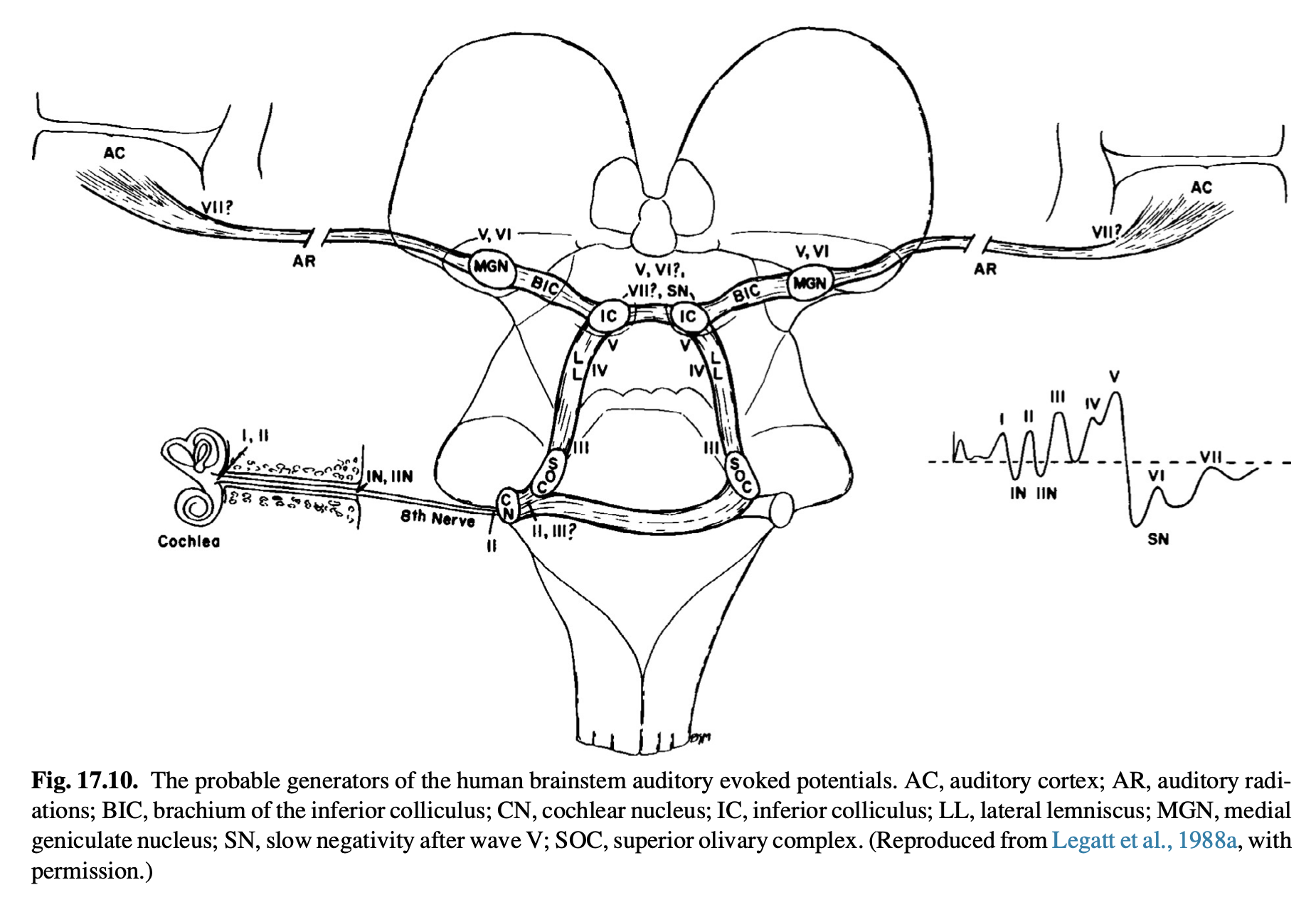 Figure: Anatomical depiction of the pathways reflected in ABRs.  From Legatt (1988).