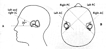 Figure: Co-planar arrangements of pairs of semicircular canals.  From http://www.opt.indiana.edu/v665/CD/CD_Version/CH13/CH13.HTM (accessed 2/25/2016).