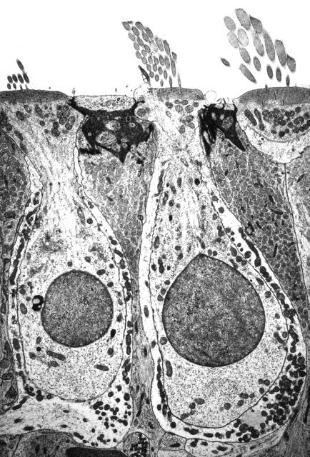Figure: Electron micrograph of several adjacent cochlear hair cells.  From http://otopathologynetwork.org/tbimages/chapter2/image148/ (accessed 2/25/2016).