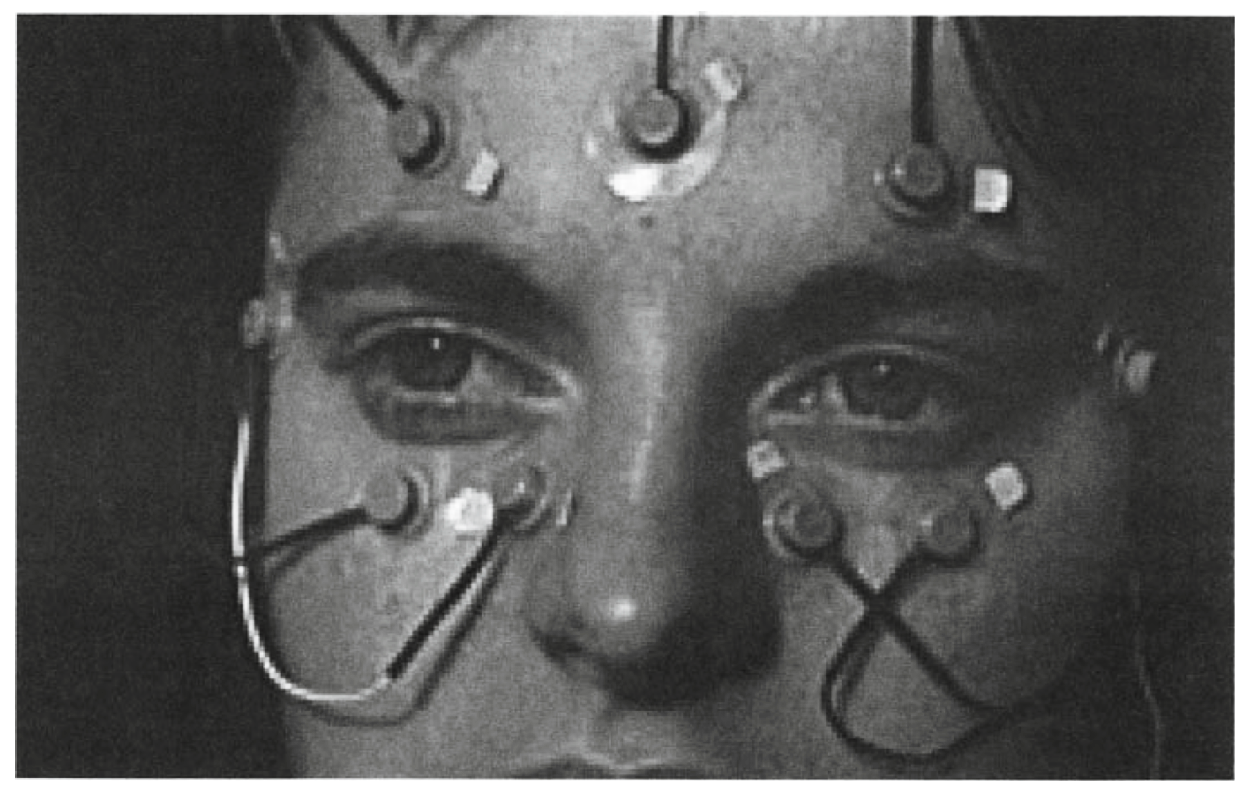 Figure: Electronystagmography surface electrode placement.  From Duchowski (2003).