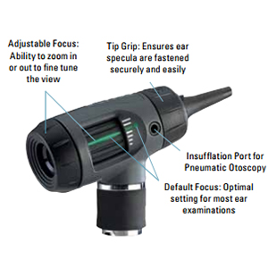 Figure: Handheld monocular otoscope with adjustable focus.  From https://www.healthproductsforyou.com/p-welch-allyn-digital-macroview-otoscope.html (accessed 4/21/23).