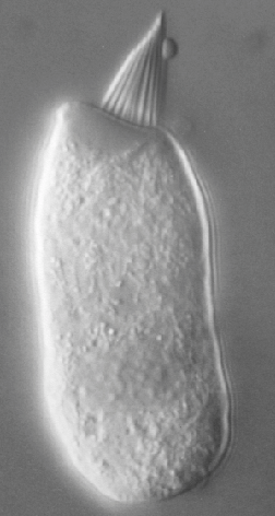 Figure: Isolated type 1 cochlear hair cell under light microscopy.  From http://umech.mit.edu/hearing/intro/intro.html (accessed 2/25/2016).