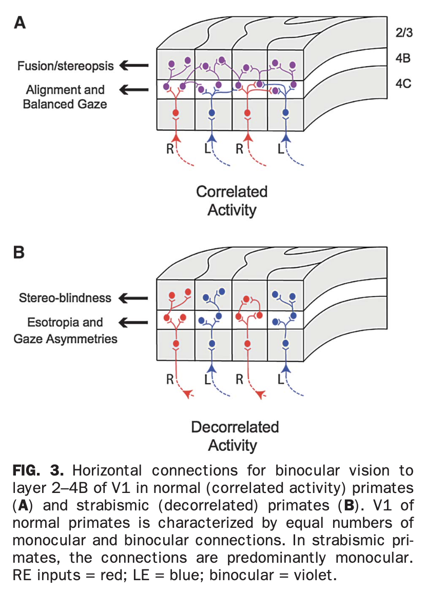 Figure: Normal synaptic configuration in the visual cortex for functioning binocular vision (panel A), and abnormal synaptic configuration in the visual cortex for failure of binocular vision (panel B).  From Tychsen et al. (2010). 