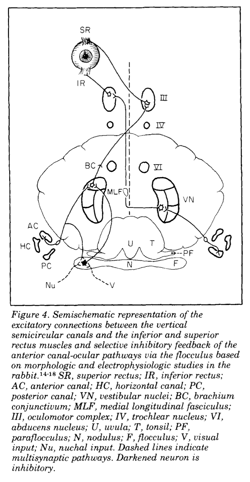 Figure: Oligoneuronal circuits underlying some of the mechanisms involved in spontaneous down beat jerk nystagmus.  From Baloh and Spooner (1981).