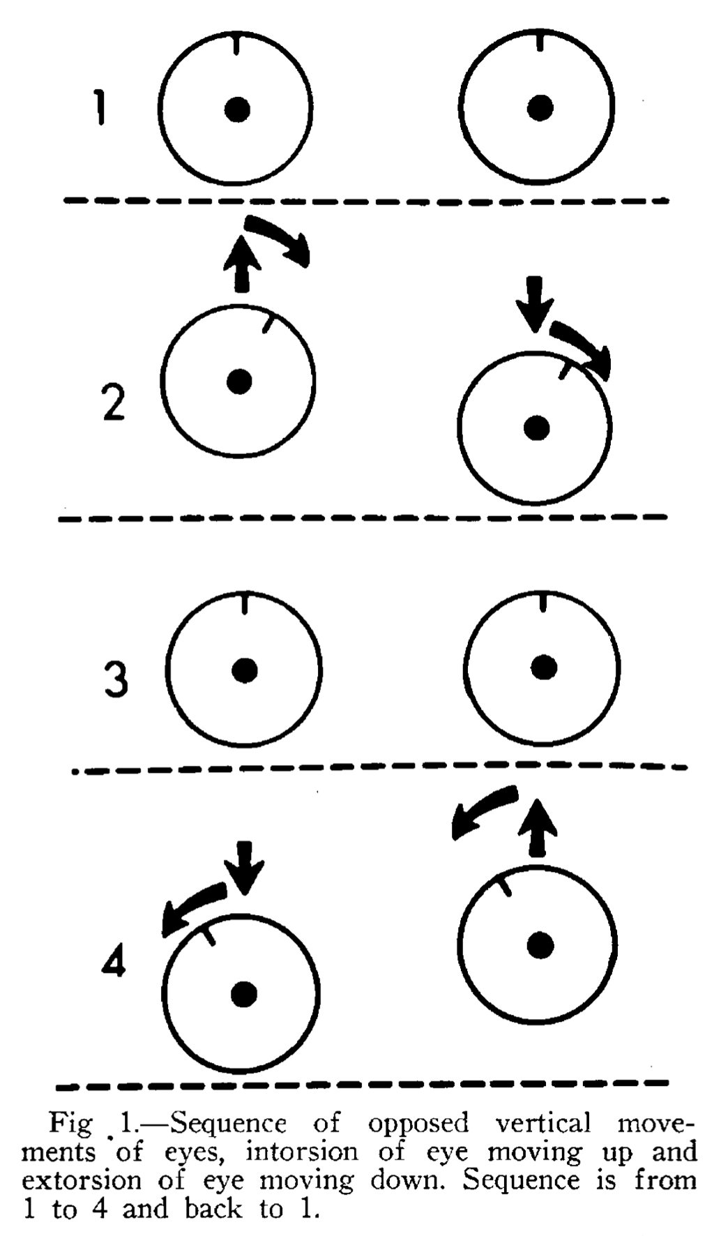 Figure: Schematic diagram of the cycle of eye movements in see-saw nystagmus.  From Druckman et al. (1966).