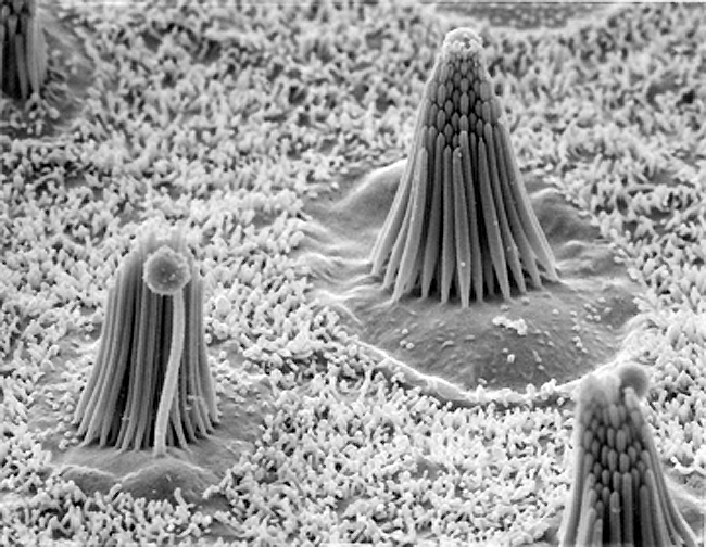 Figure: Several cochlear hair cells embedded among sustentacular cells of the basilar membrane.  From http://hms.harvard.edu/news/firm-molecular-handshake-needed-hearing-balance-11-8-12 (accessed 2/25/2016).