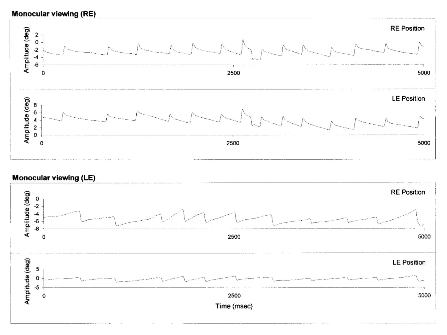 Figure: Tracings of horizontal eye movements in latent nystagmus.  From Abadi and Scallan (2000).