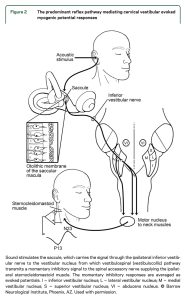 Figure: Schematic of neuroanatomical pathways mediating cervical vestibular evoked myogenic potentials. From Fife et al. (2017).