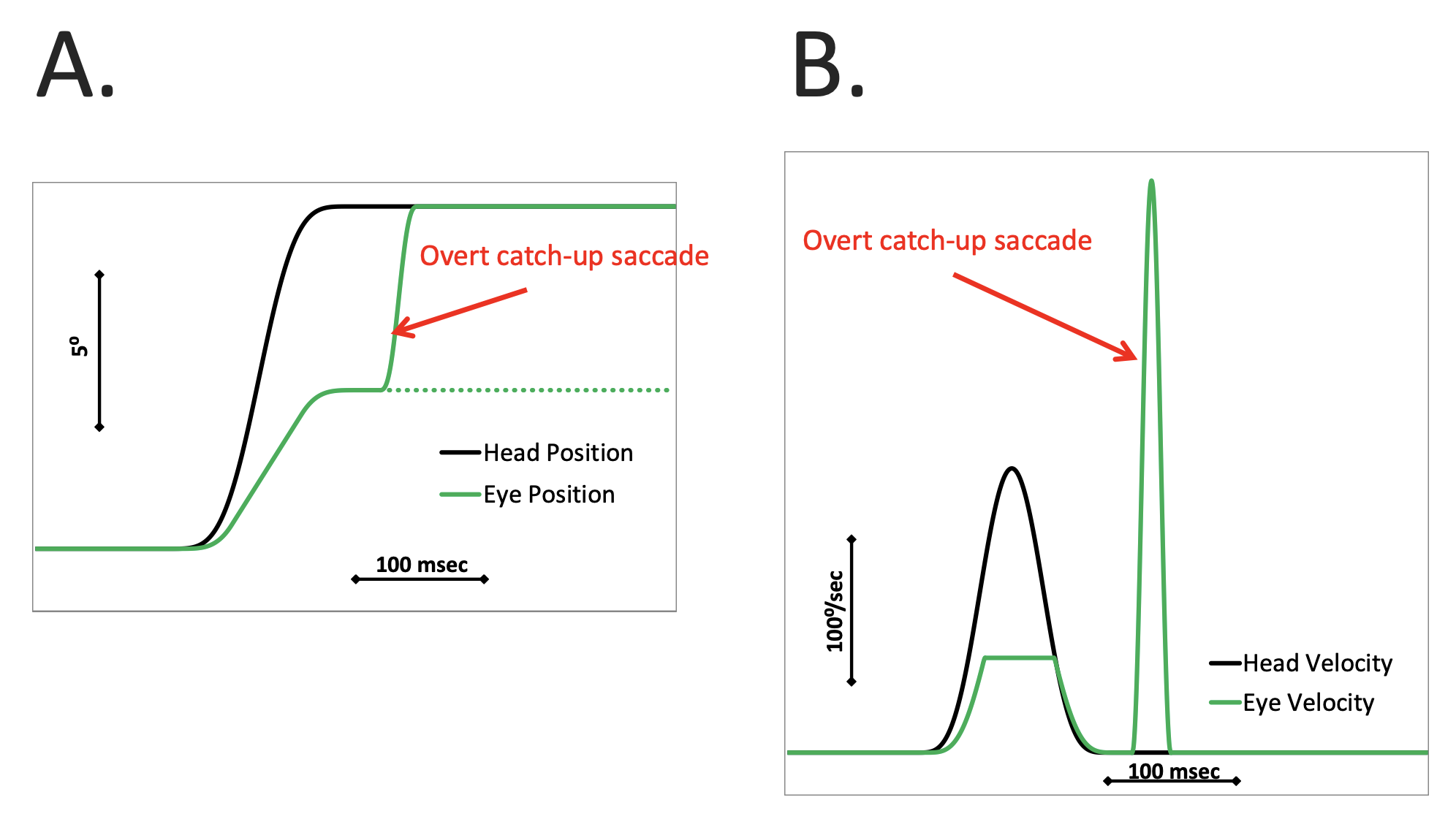 Figure: Overt corrective saccade in video head impulse testing.