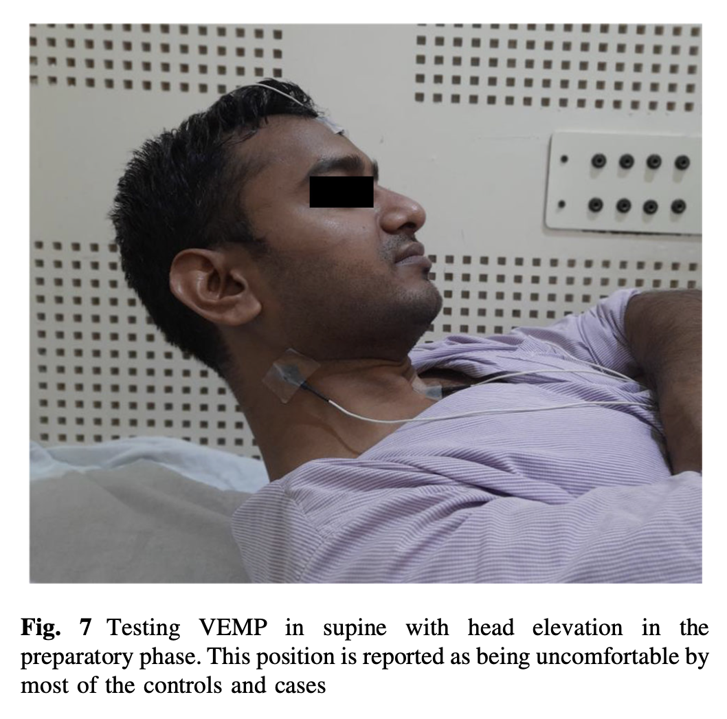 Figure: Activating the sternocleidomastoids by raising the head off the table.  From Kumar et al. (2021).