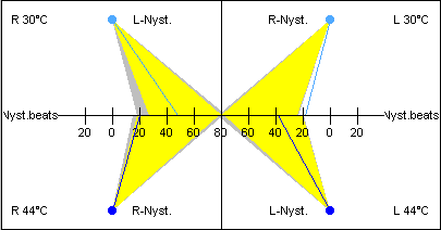 Figure: Example of a Haid/Stoll diagram.