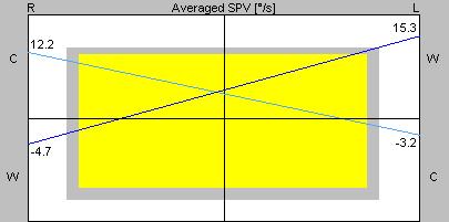 Figure: Example of normal Freyss diagram.