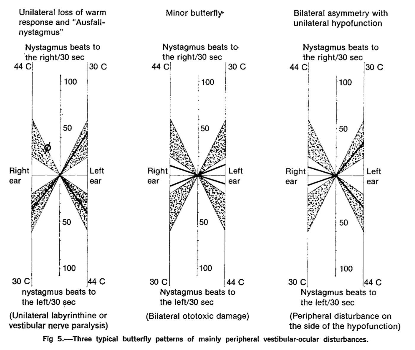 Figure: Examples of Claussen diagrams.  From Claussen and von Schlachta (1972).