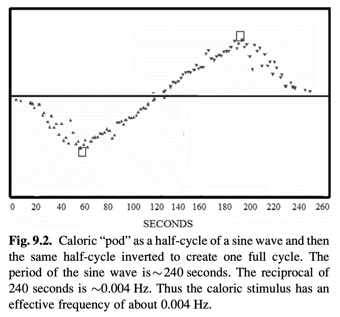 Figure: How response to caloric stimulation translates into a "frequency" of vestibular response.  From Shepard and Jacobson (2016).