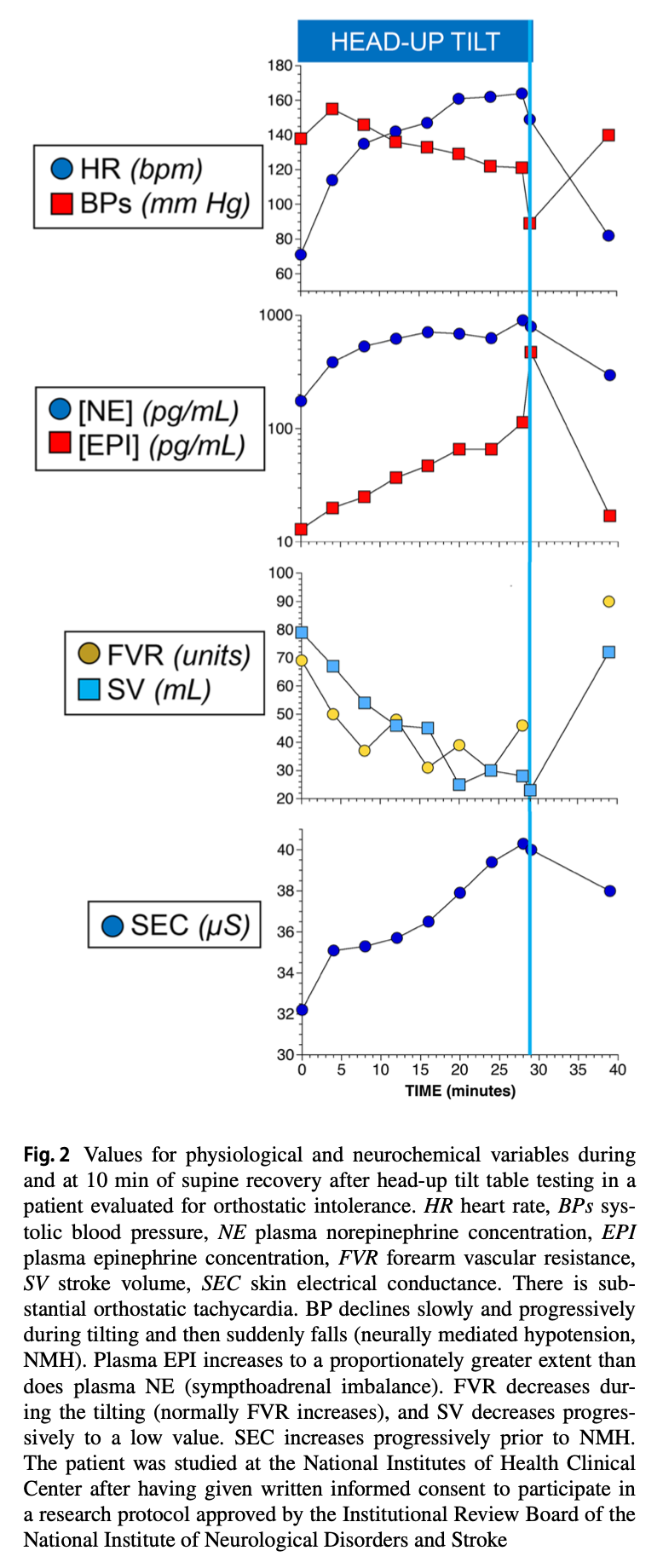 Figure: Idealized graphs of several physiologic variables during tilt table testing.  From Cheshire and Goldstein (2019).