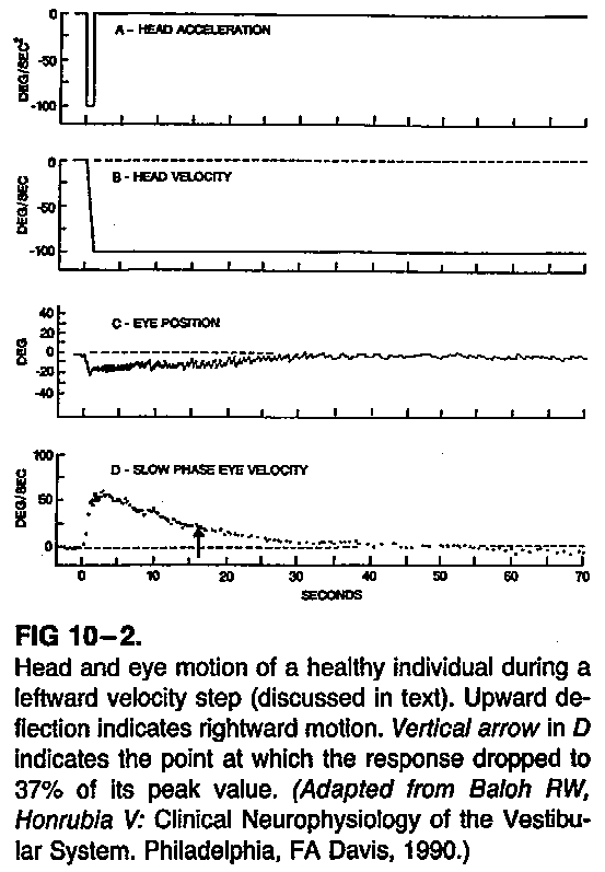 Figure: Normal step velocity testing to the left.  From Stockwell and Bojrab (1997).