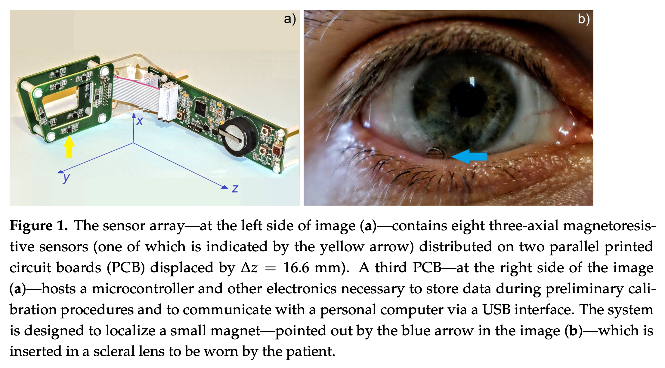 Figure: Sensor (panel a) and scleral contact with embedded magnet (panel b).  From Biancalana and Chessa (2023).