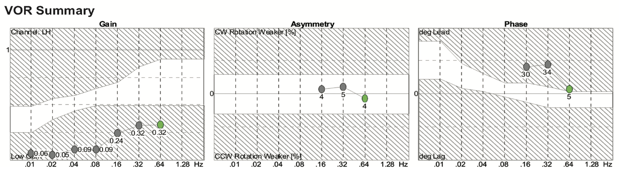Figure: Slow harmonic acceleration in bilateral vestibular loss.  From Hain et al. (2013).