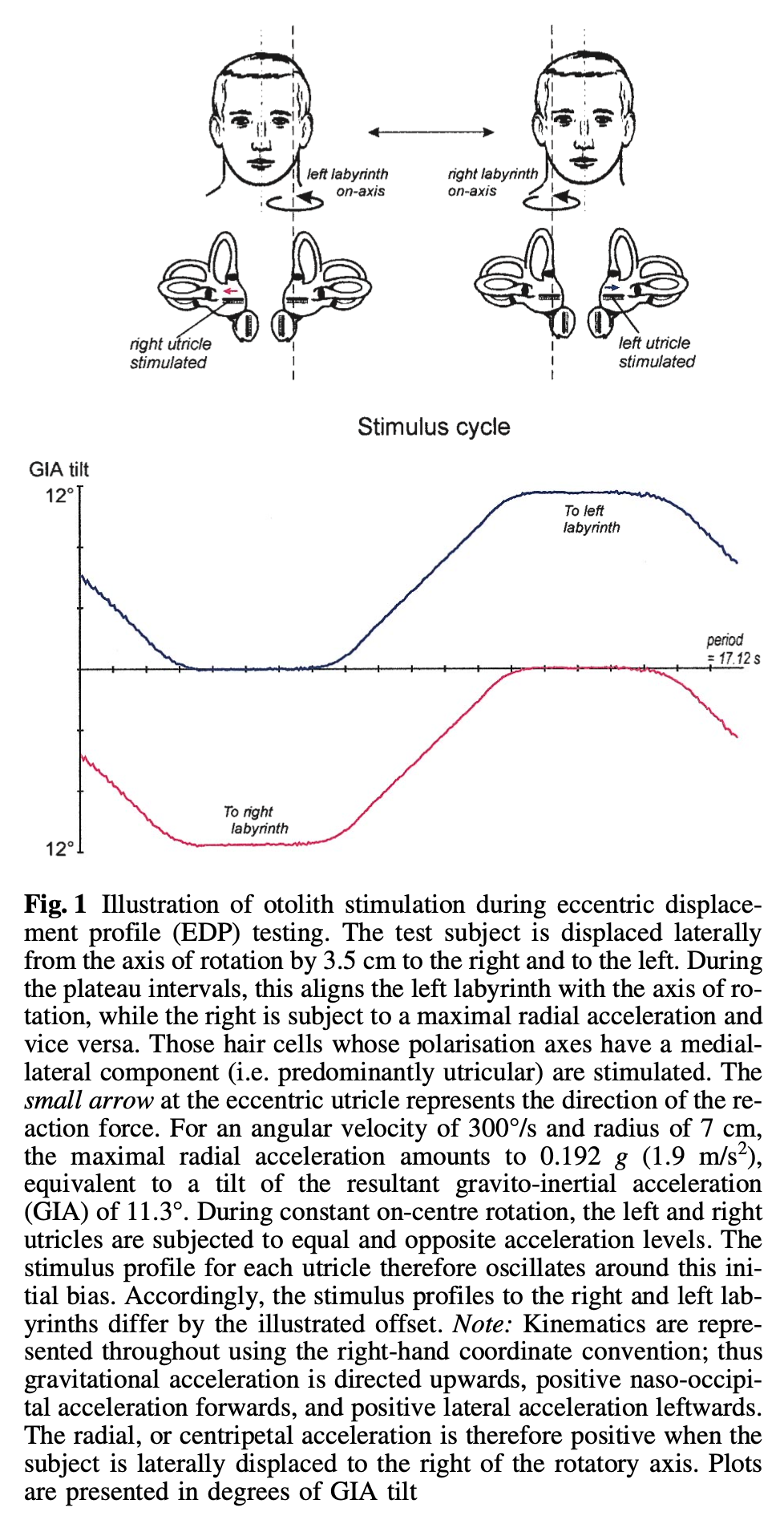 Figure: Using eccentric rotatory chair testing to assess utricular function.  From Clarke and Engelhorn (1998).