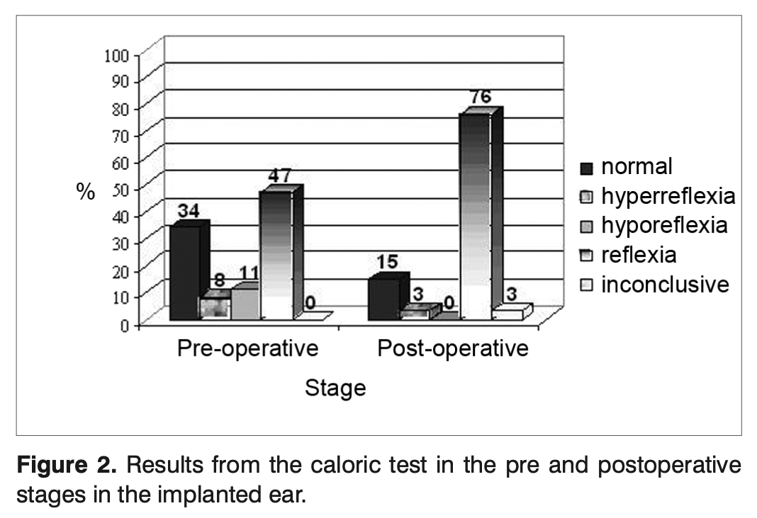 Figure: Preoperative and postoperative caloric responses in an implanted ear.  From Bonucci et al. (2008).