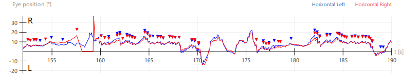 A graph with red and blue lines

Description automatically generated