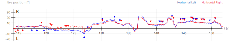 A graph with red and blue lines

Description automatically generated