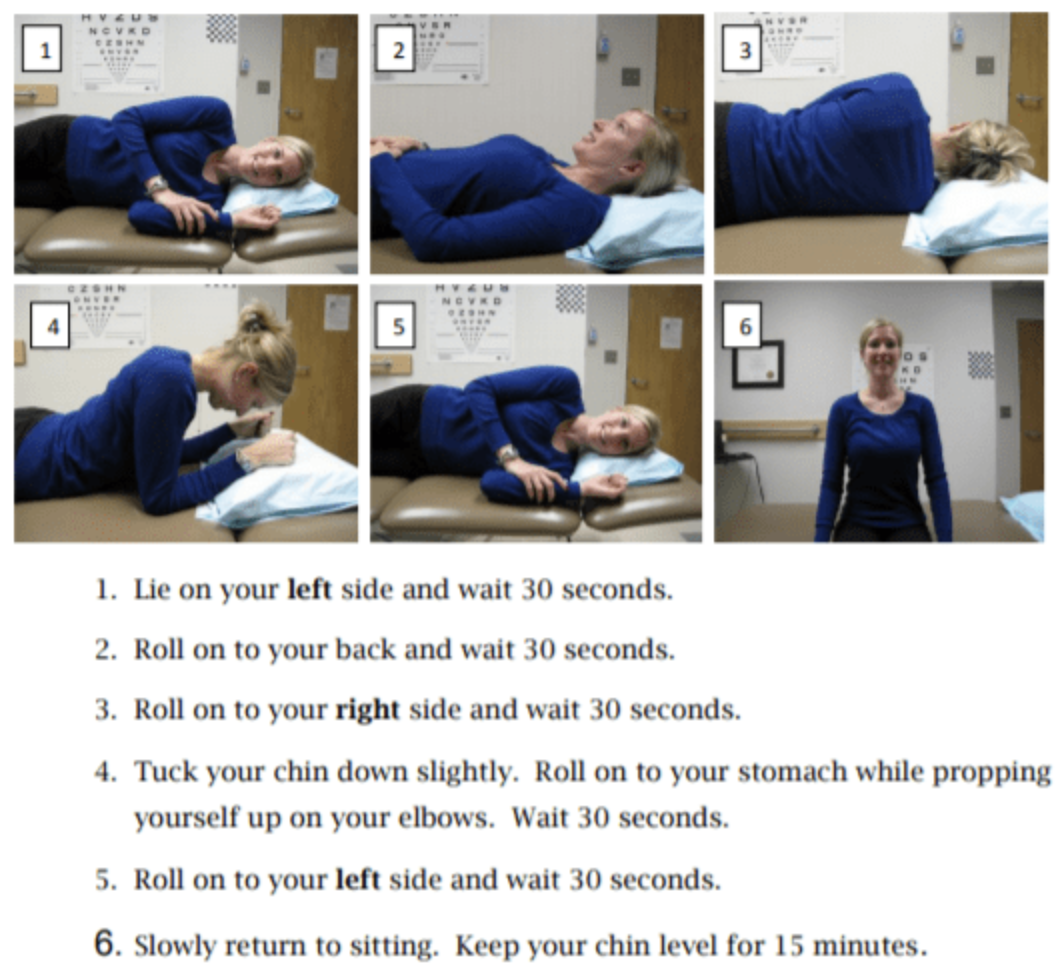 Figure: Left-sided Lempert roll for left-sided lateral canal BPPV. From https://www.vestibular.today/bppv-resources (accessed 2/23/2025).