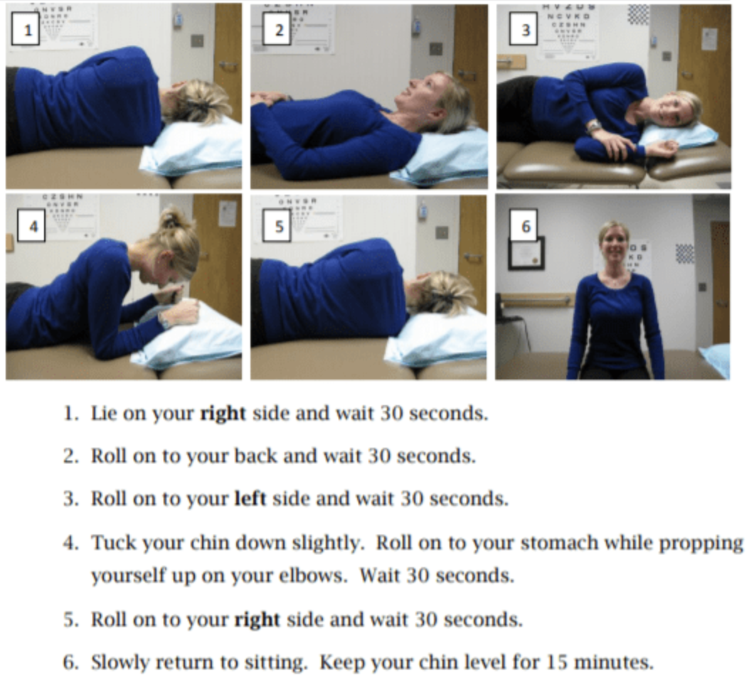 Figure: Right-sided Lempert roll for treatment of right-sided lateral canal BPPV. From https://www.vestibular.today/bppv-resources (accessed 2/23/2025).