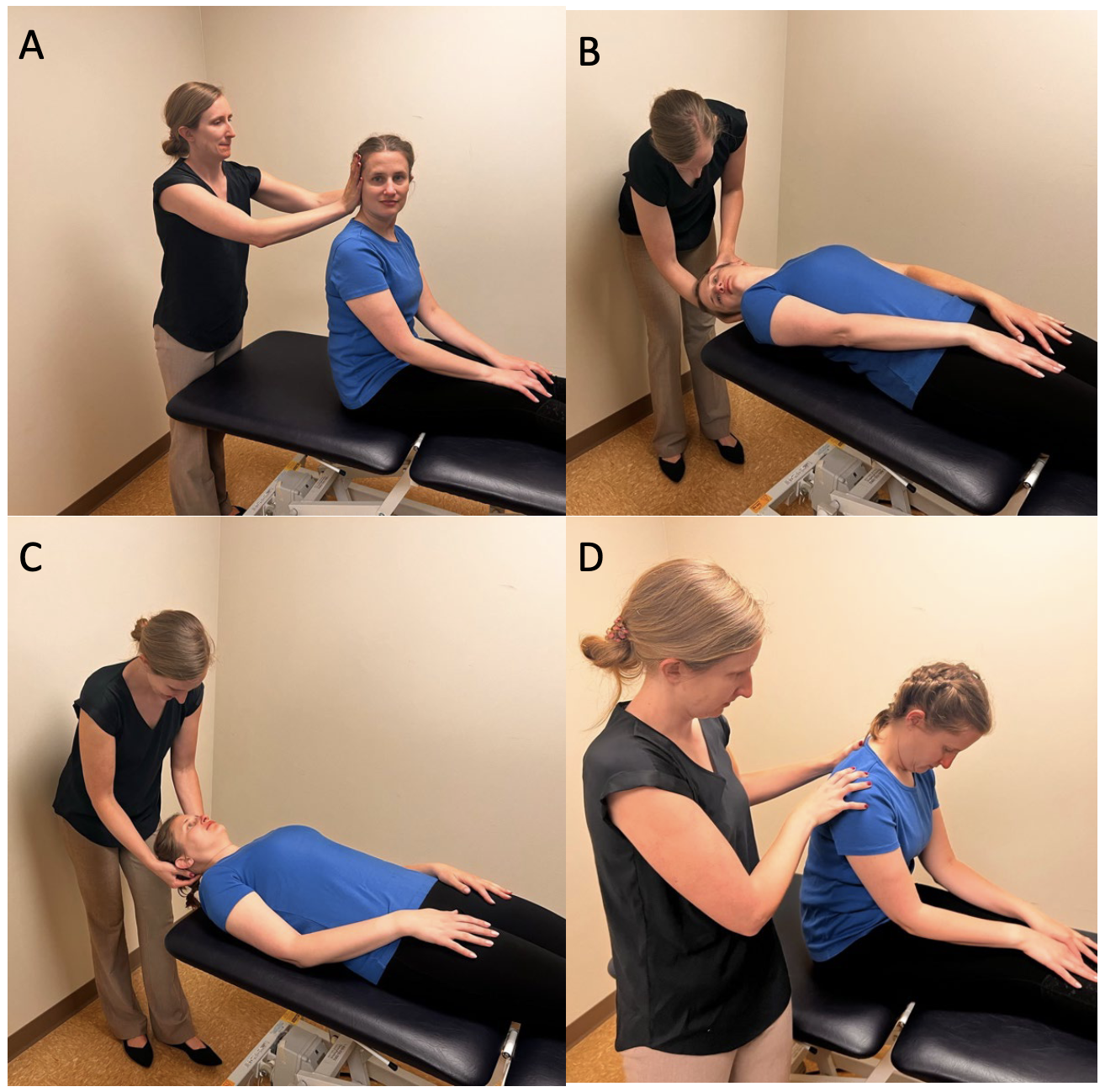 Figure: Kim maneuver for treating left-sided anterior canal BPPV. The perspective is from an examiner standing at the patient’s right side. From https://collections.lib.utah.edu/ark:/87278/s6aryz6c (accessed 2/23/2025).