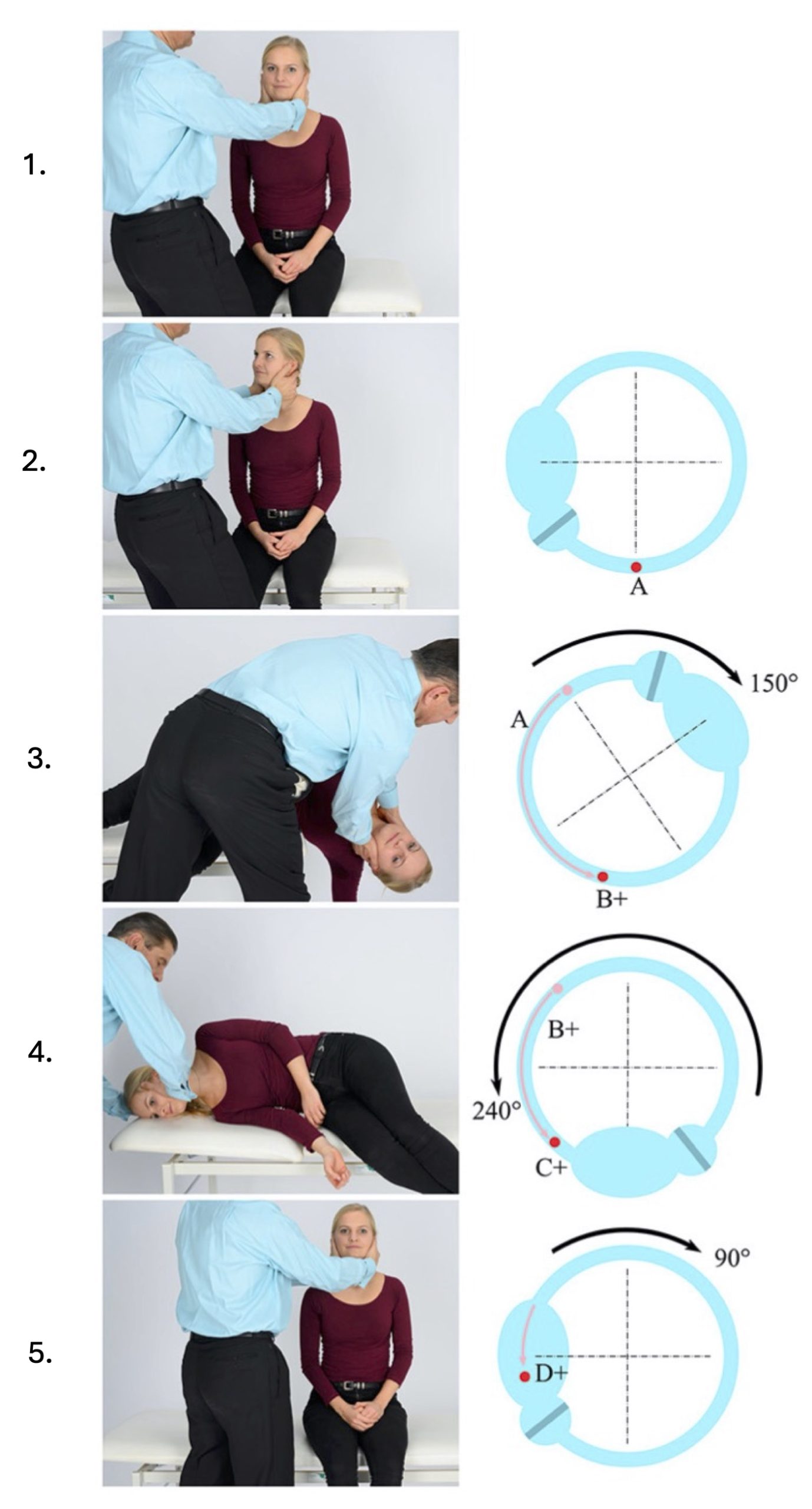 Figure: Left-sided Semont plus maneuver for treating BPPV involving the left-sided posterior canal. From Strupp et al. (Strupp et al. 2021).