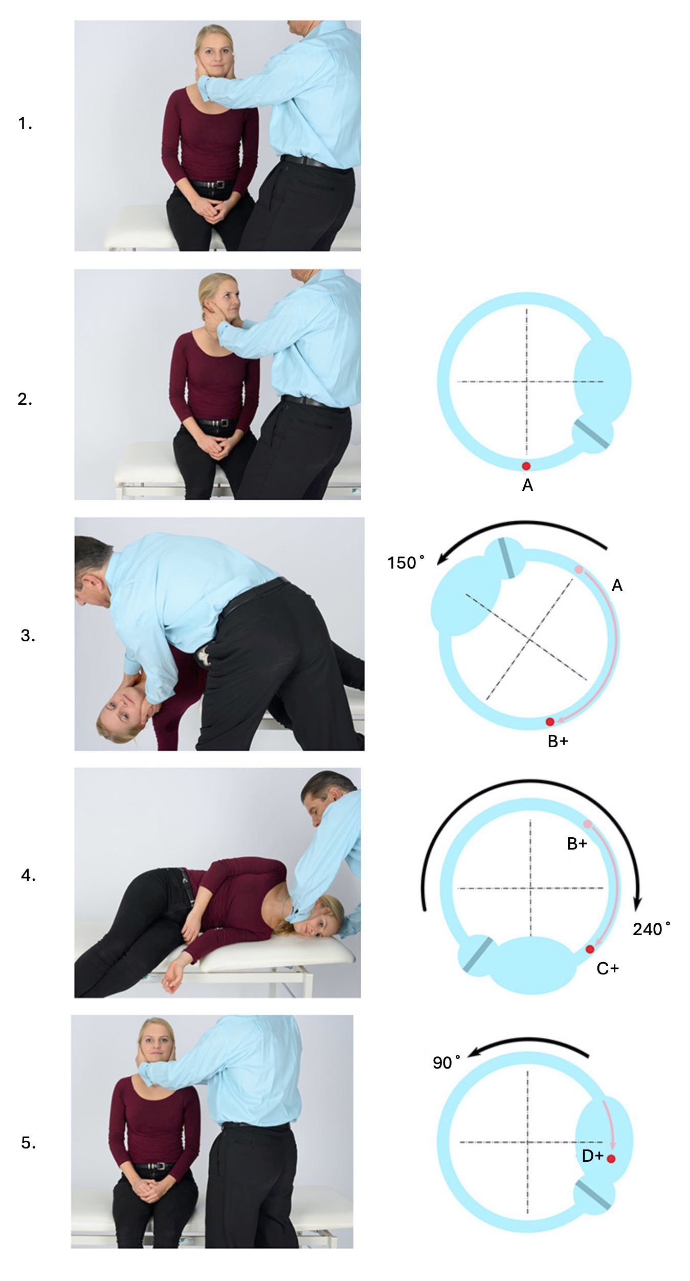 Figure : Semont plus maneuver for treating right-sided posterior canal BPPV. Adapted from Strupp et al. (Strupp et al. 2021).