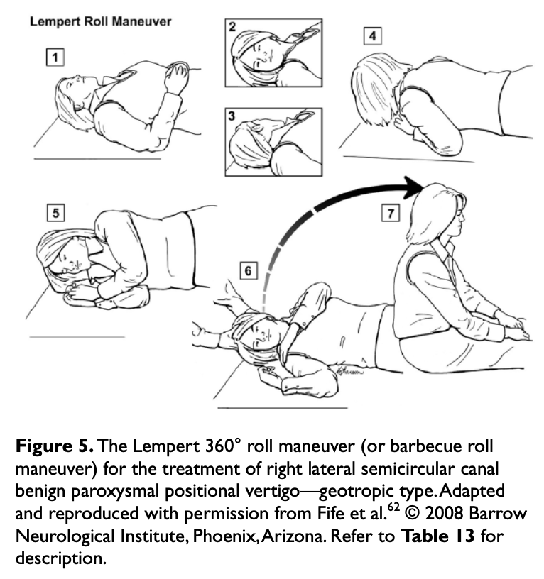 Figure: Right-sided Lempert roll for right-sided lateral canal BPPV. From Bhattacharyya et al. (Bhattacharyya et al. 2017).