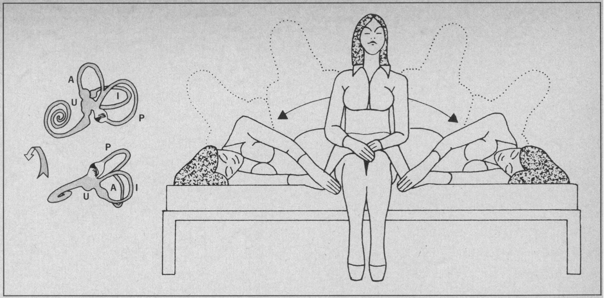 Figure: Brandt-Daroff maneuver.  From Brandt and Daroff (1980).