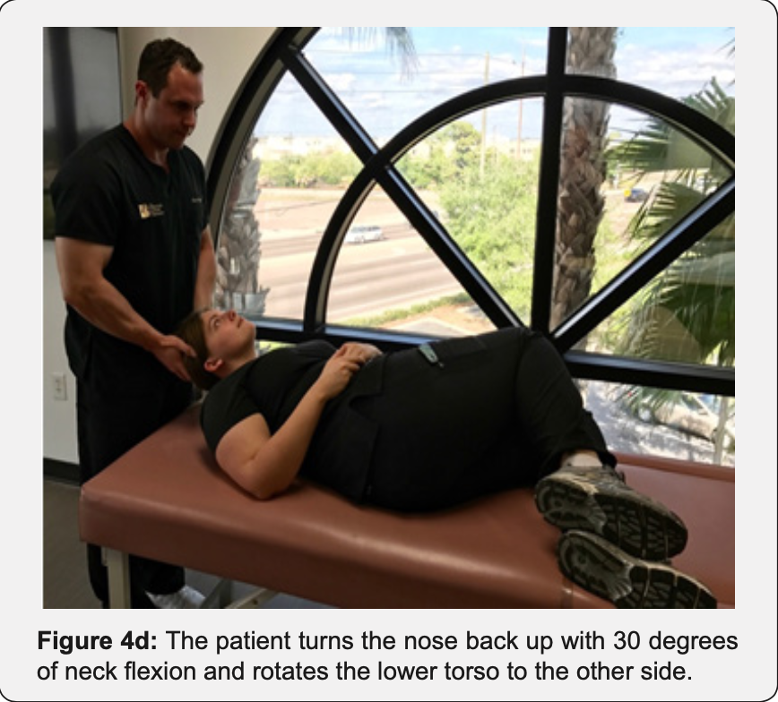 Figure: Kurtzer hybrid maneuver, step 4.  From Ganz et al. (2017).
