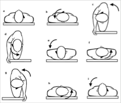 Figure: Right-sided Lempert roll for right-sided lateral canal BPPV. From Bittar et al. (Bittar et al. 2011).