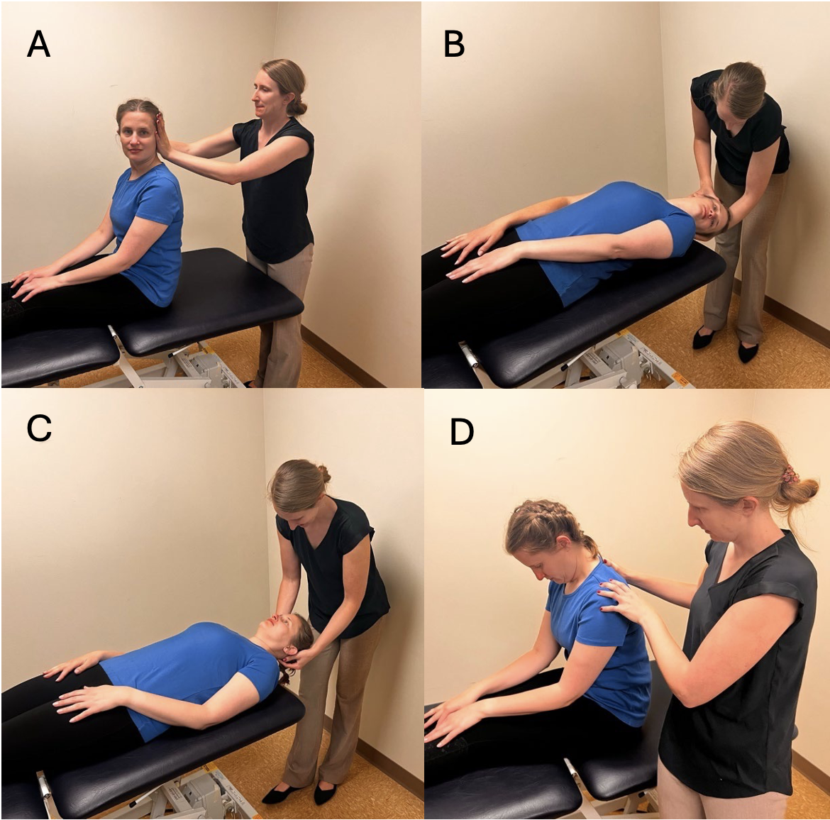 Figure: Kim maneuver for right-sided anterior canal BPPV. The perspective is from an examiner standing on the patient’s left side. Adapted from materials at the University of Michigan.